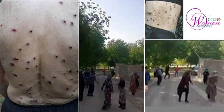 thirty-women-wounded-in-Sarab-e-Kahman-village