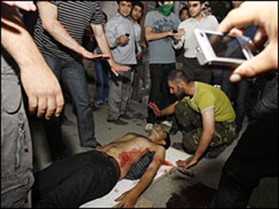 A wounded protestor of June 15, 2009