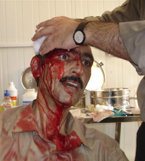 An injured man receives treatment in the hospital of Camp Ashraf after Iraqi forces attacked unarmed residents of the Camp, north of Baghdad July 29, 2009. At least twelve of the members of the People’s Mojahedin Organization of Iran (PMOI/MEK) killed in attack hundreds wounded.